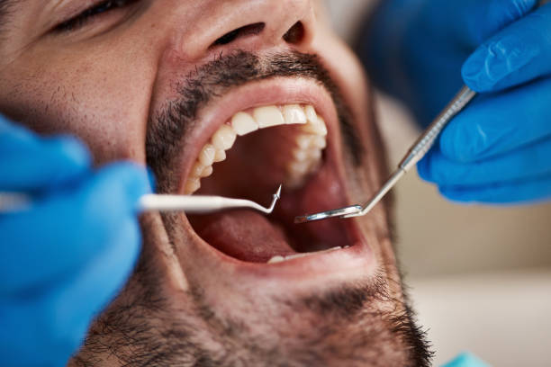 Best Emergency Broken Tooth Repair in Youngtown, AZ